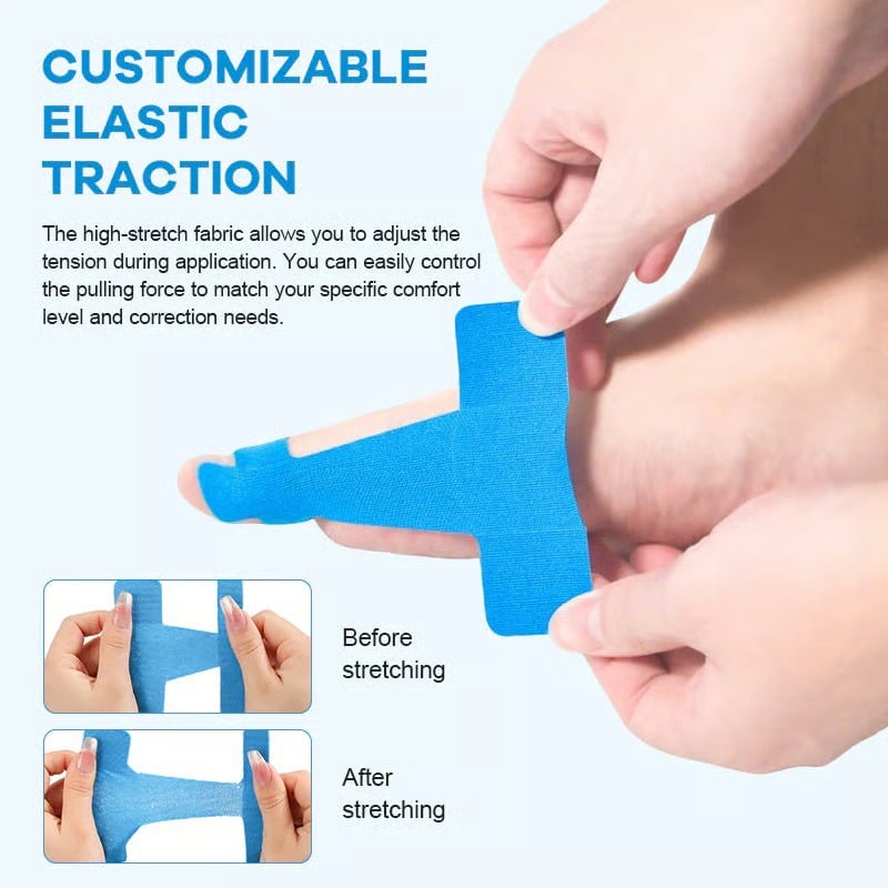 Pre-Cut Bunion Corrector Tape