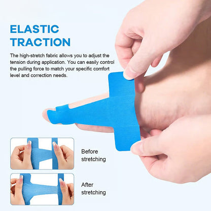 Pre-Cut Bunion Corrector Tape