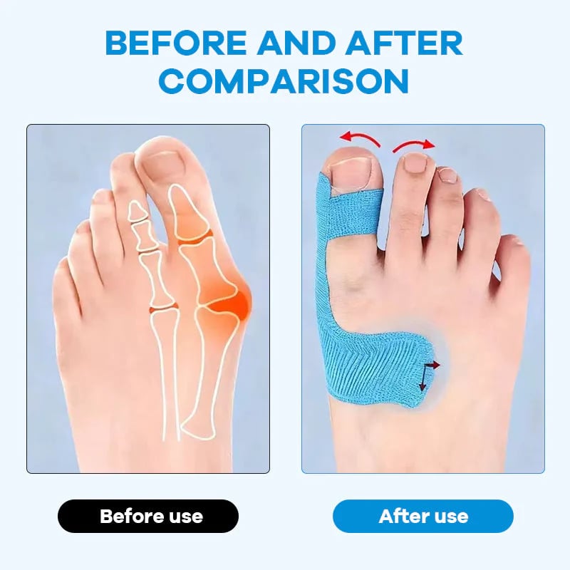 Pre-Cut Bunion Corrector Tape