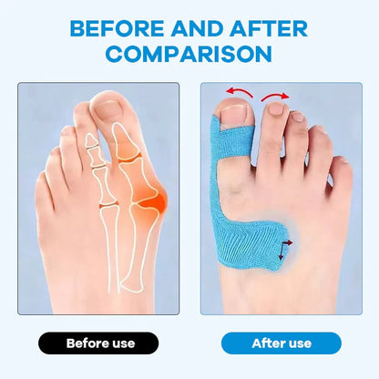 Pre-Cut Bunion Corrector Tape